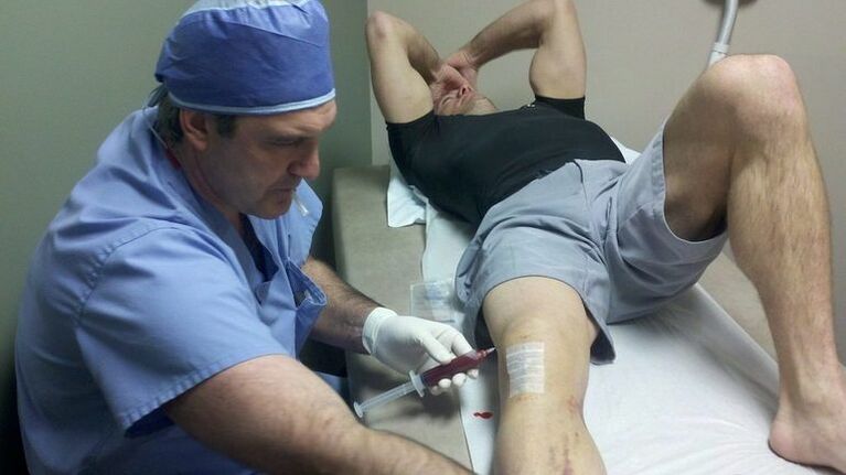 Treatment of arthrosis of the knee joint